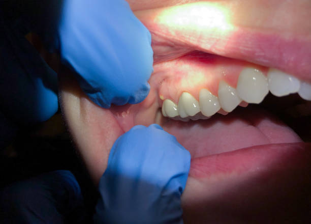 Best Emergency Treatment for Jaw Pain or Injury in Spindale, NC